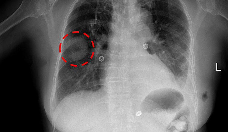 S_m_h_Q's tweet card. New research shows radiologists and AI don’t always work well together