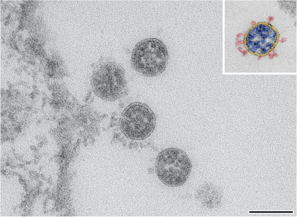 DominiekC's tweet card. Scientific Data - Electron microscopy images and morphometric data of SARS-CoV-2 variants in ultrathin plastic sections