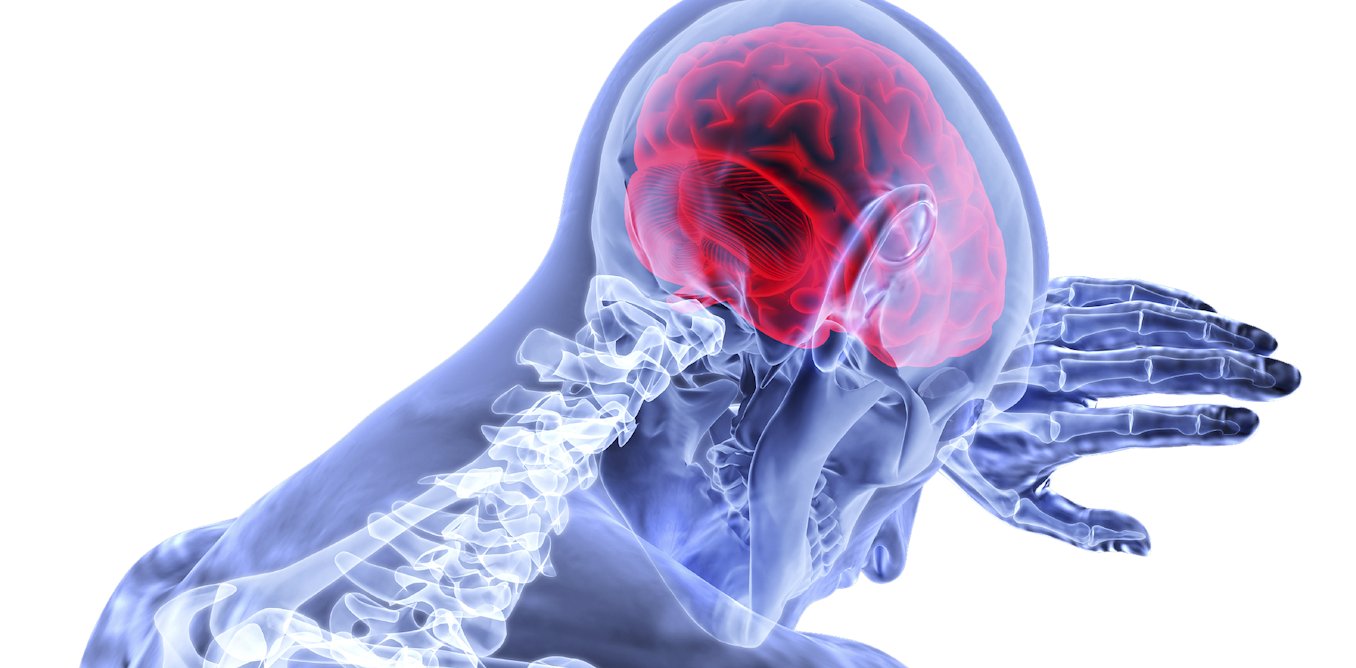 CVerdaich's tweet card. Un nouveau traitement pourrait permettre de préserver les capacités motrices des patients qui ont subi un AVC. Il pourrait changer les stratégies médicales pour d’autres maladies neurodégénératives.