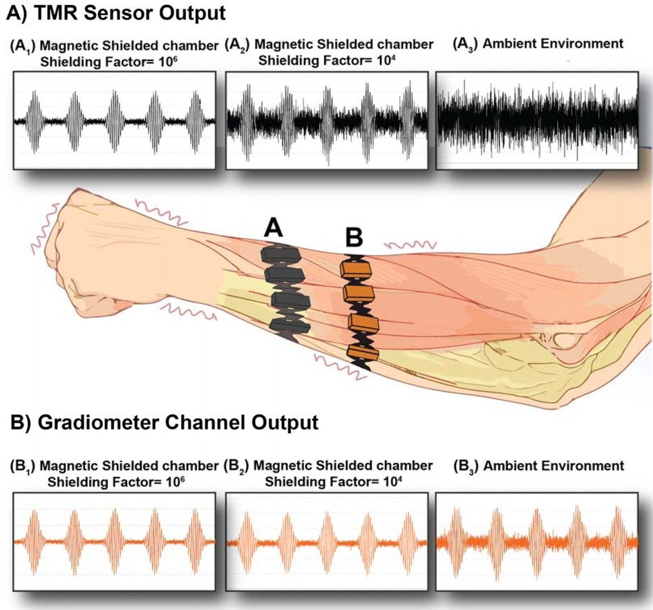 neuranics's tweet card. Motion artifacts can be a significant noise source in biomagnetic measurements when magnetic sensors are not separated from the signal source. In ambient env...