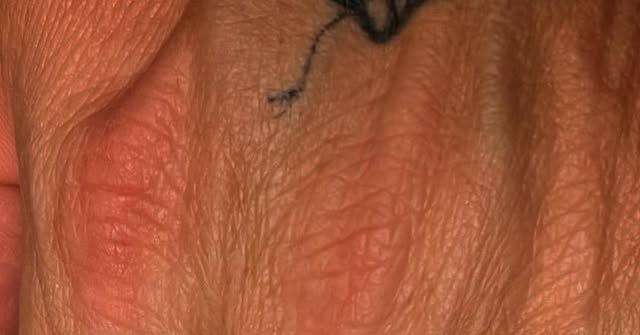 Tweet card summary image