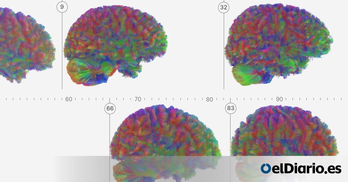 eldiarioes's tweet card. Mediante la comparación de casi 4.000 cerebros de distintas edades, investigadores de Cambridge han determinado las cinco grandes etapas en la evolución neuronal a lo largo de la vida humana, con sus...