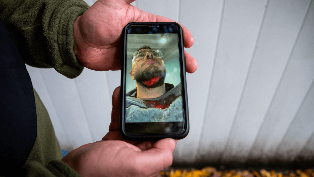 LouisBoyard's tweet card. À Villecresnes (94), Mourad a été agressé au cutter par un septuagénaire. Dans des vidéos que s’est procurées StreetPress, l’agresseur insulte le jeune homme sur son lieu de travail de « bougnoule »,...