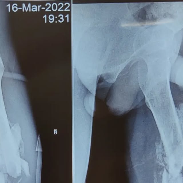 thatorthodoc's tweet card. Dr. Diksha | Dr. Pratik | The OrthoDerma Clinic | Gorakhpur (@orthoderma.in) • Instagram photos and...