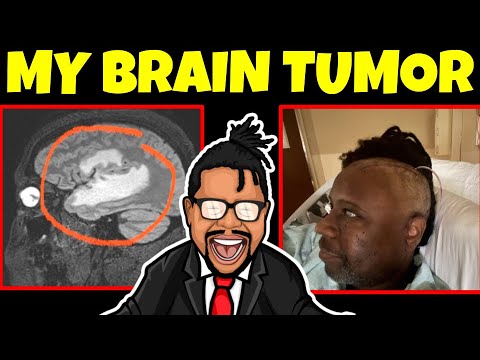 NatetheLawyer's tweet card. I Survived A Massive Brain Tumor | Health Care Is Expensive In The US.