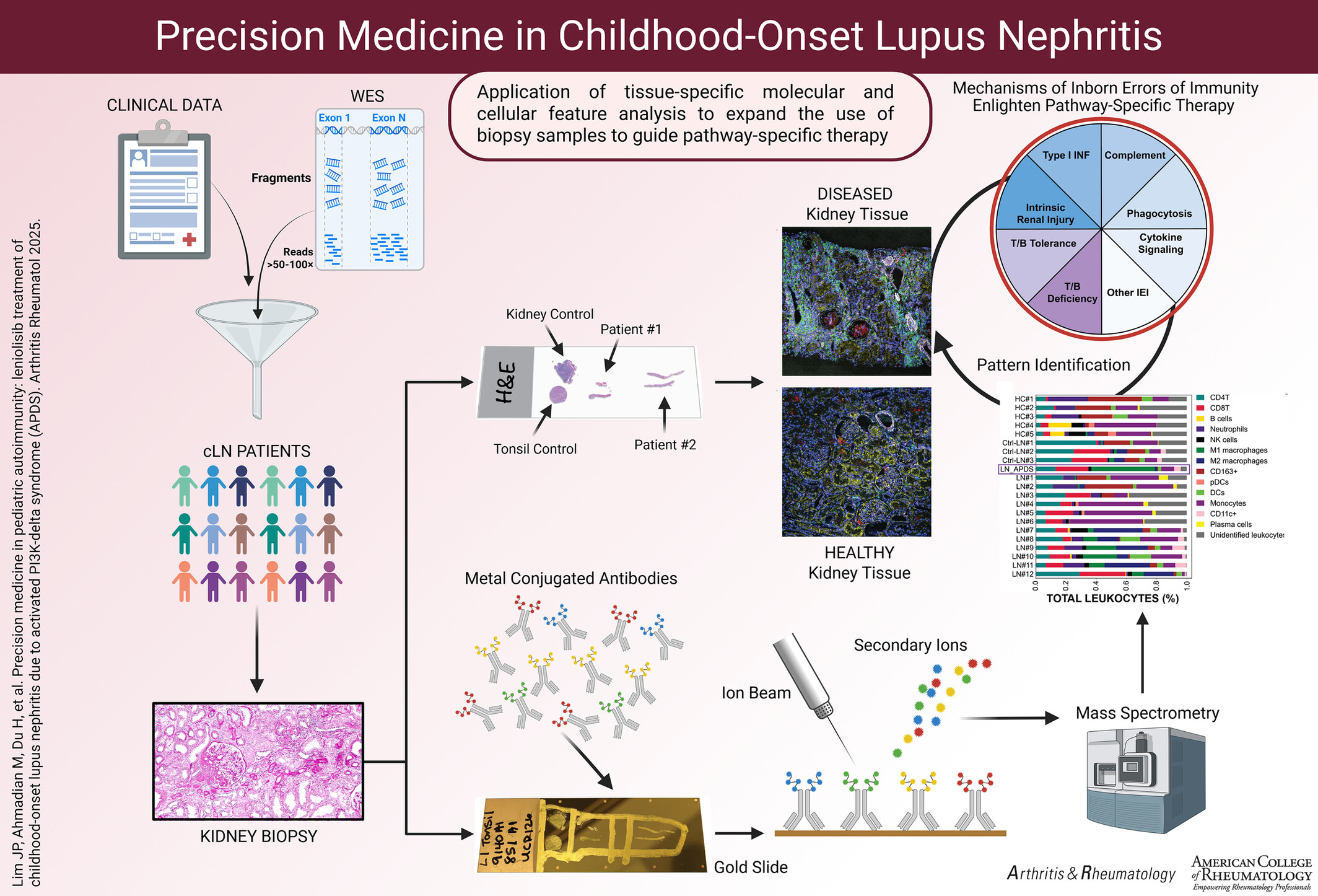 HsiehElena's tweet card. Objective The objective of this study was to investigate the mechanistic underpinnings and treatment response of lupus nephritis (LN) in activated phosphoinositide 3-kinase δ syndrome type 1 (APDS1...