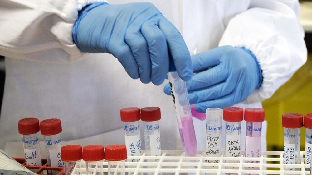 Genartis1's tweet card. Genartis, start up innovativa nata dall'università di Verona, ha lanciato il primo test in grado di rilevare la presenza delle varianti genetiche associate al Covid-19 grave