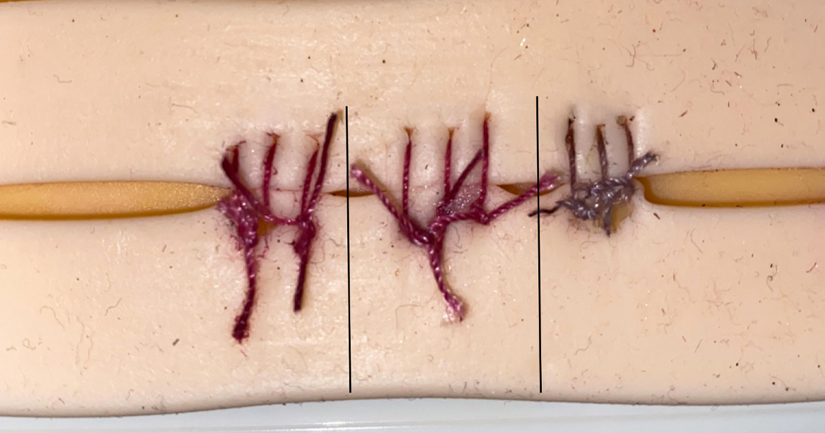 michaelmina_lab's tweet card. The color-changing sutures may be able to catch infections early, preventing more surgery.
