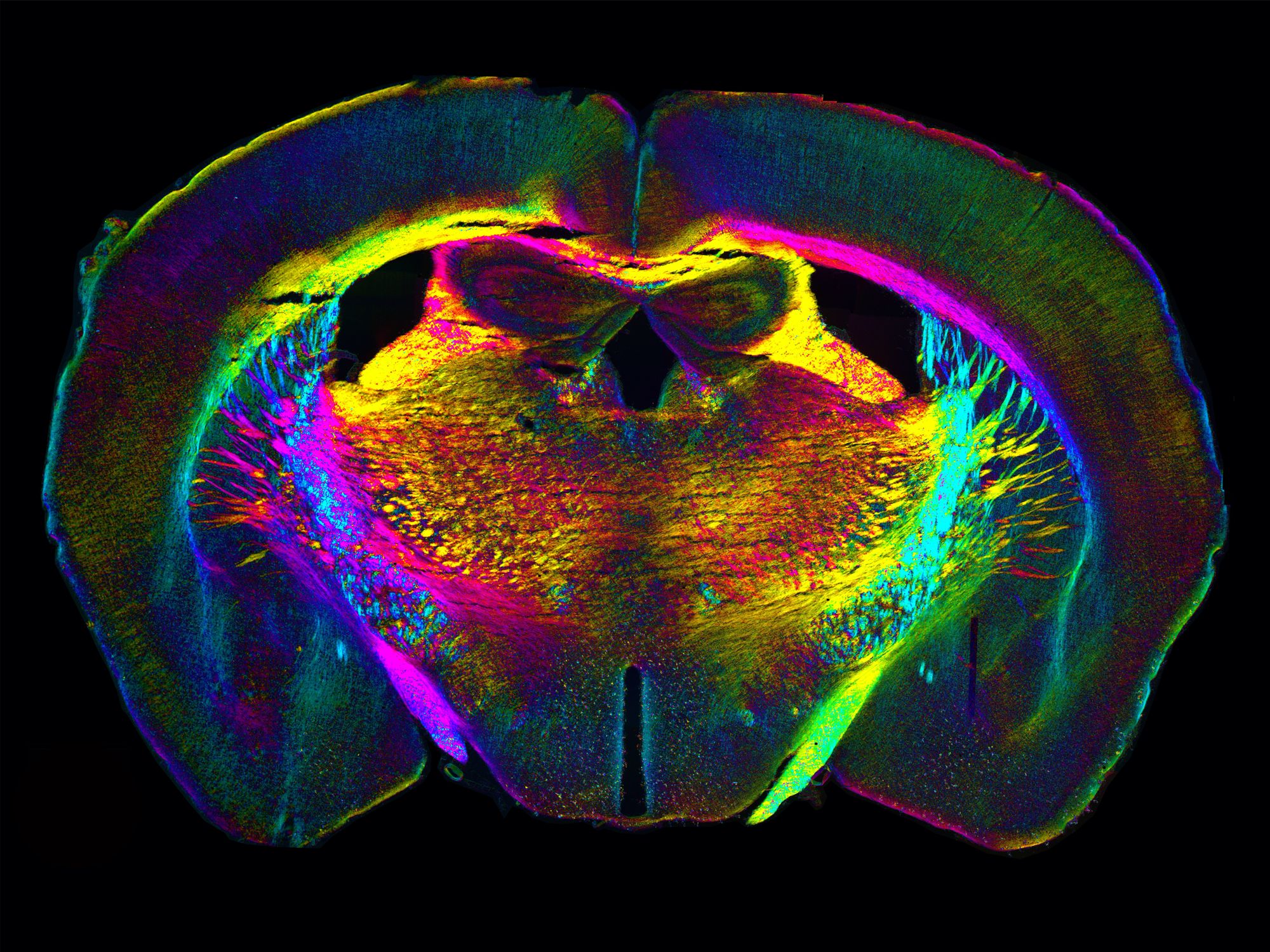 eLife's tweet card. A new computational microscopy technique could make it easier to study live cells and human tissues without using fluorescent labels.