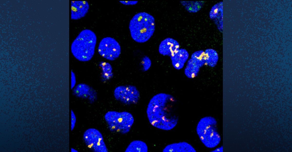 xuashleychen1's tweet card. UC San Diego researchers have helped discover that a drug used to treat pinworms, can be repurposed to rejuvenate cellular structures and potentially treat neurodegenerative diseases like Alzheimer's...