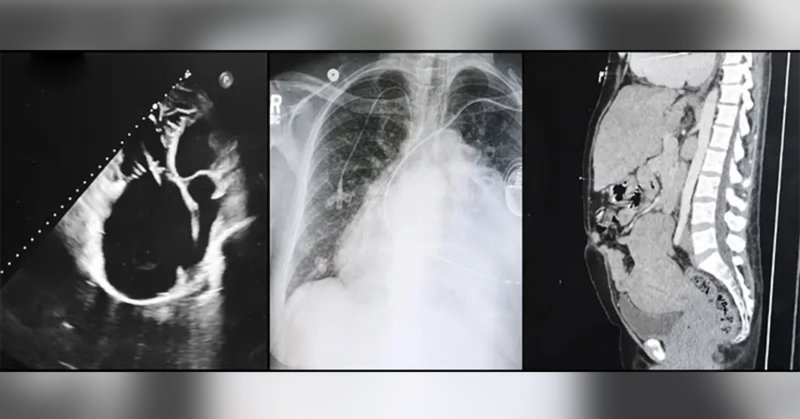 Tweet card summary image