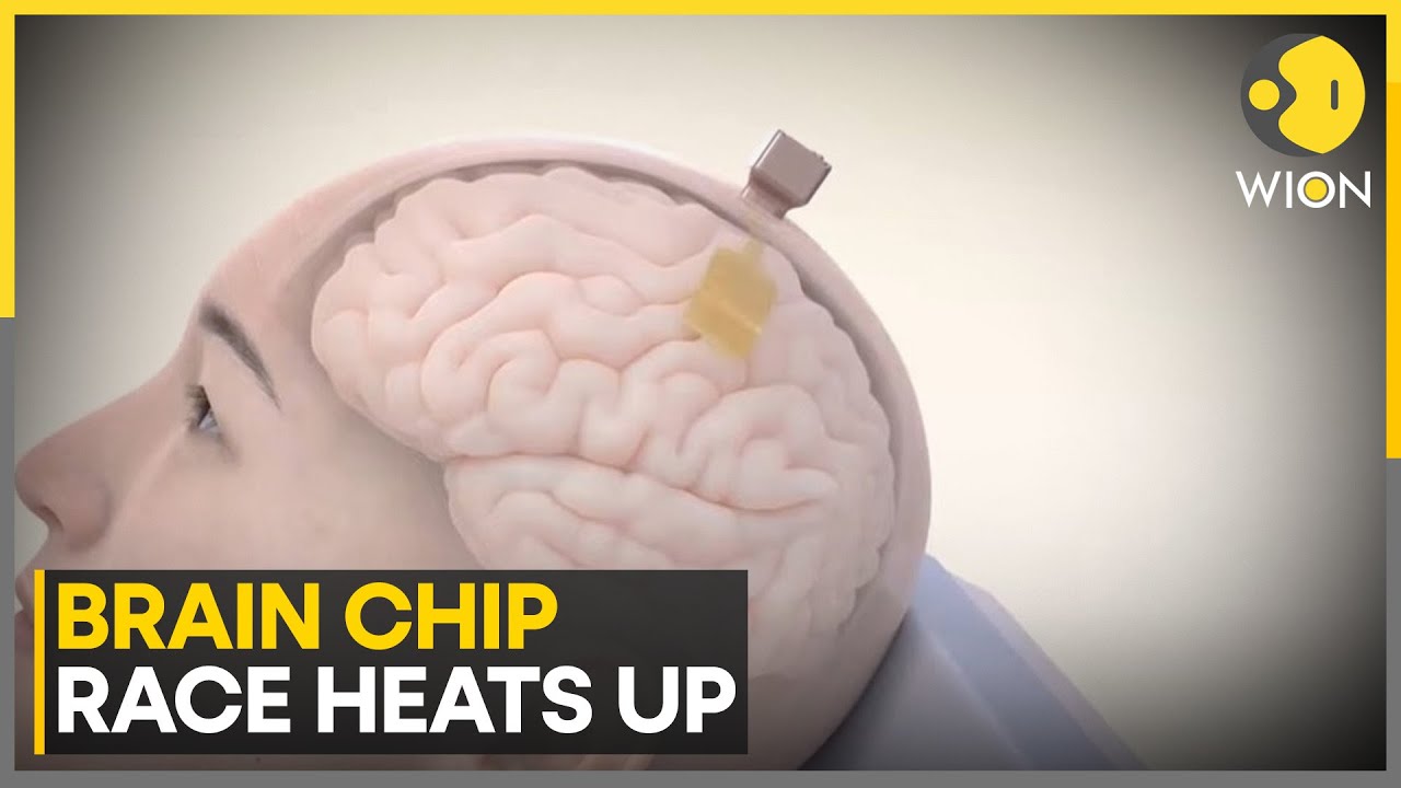 ClassicsFellow's tweet card. Brain Implants The Future Of Computing? China Aiming For Brain Chip...