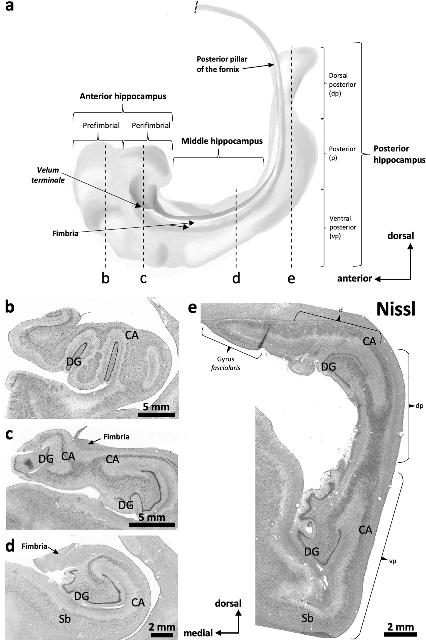 LMPrida's tweet card. Brain Structure and Function - The primate hippocampus includes the dentate gyrus, cornu ammonis (CA), and subiculum. CA is subdivided into four fields (CA1-CA3, plus CA3h/hilus of the dentate...