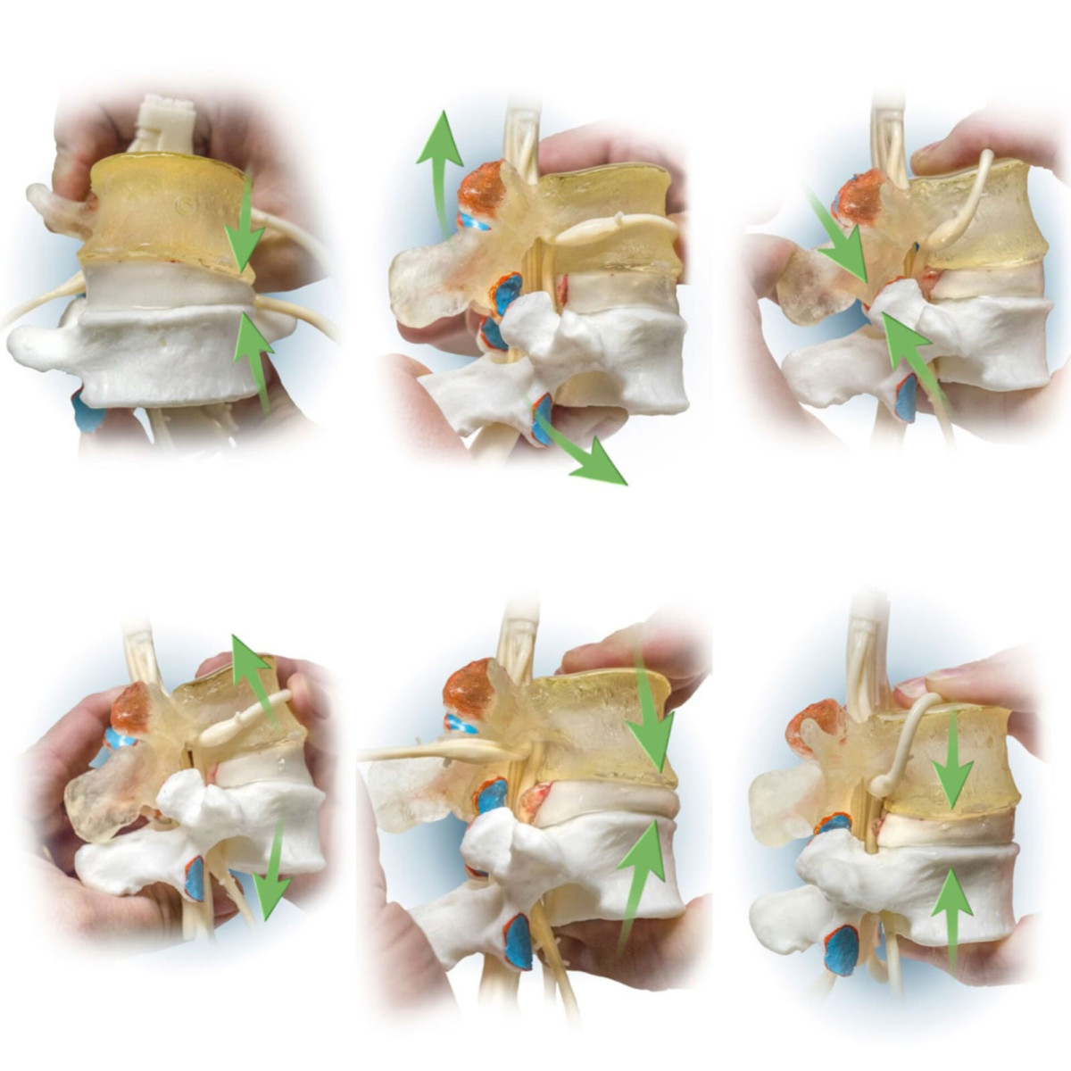 dynamicdisc's tweet card. AI lumbar disc herniation detection and research on the You Only Look Once approach. Dynamic Disc Designs