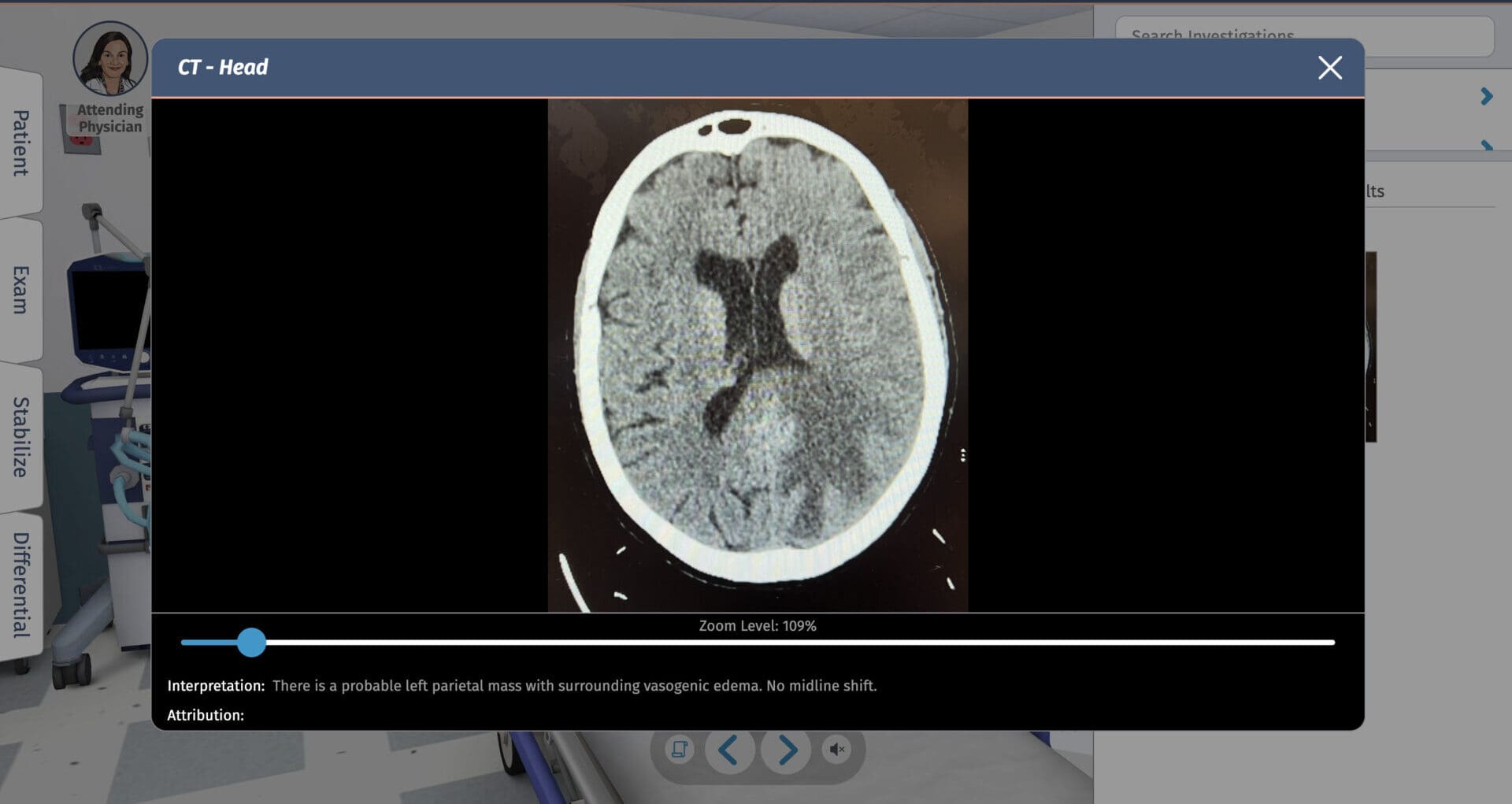 fullcodemedical's tweet card. Strokes pose a challenge in diagnosis and require time-sensitive treatment. Ischemic stroke, an interruption of blood flow to part of the brain, and hemorrhagic stroke, bleeding from a blood vessel...