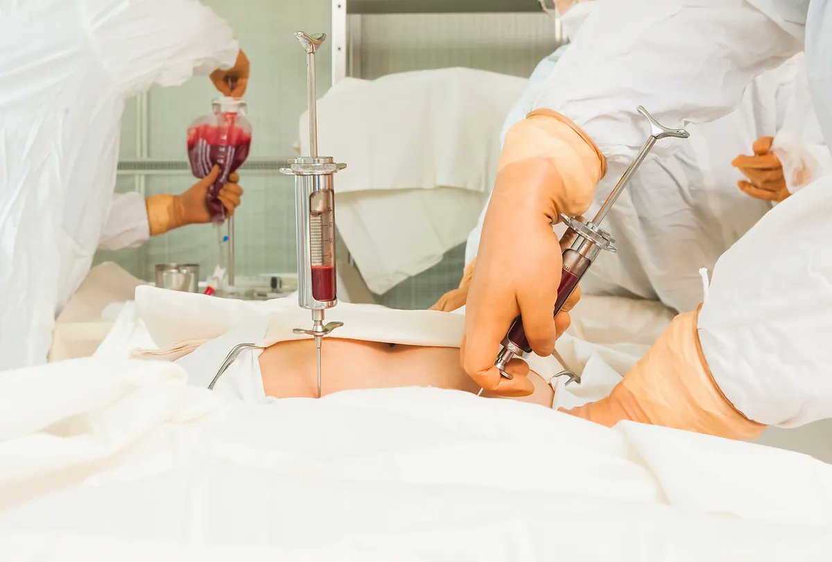 HematoHUVR's tweet card. El trasplante alogénico de progenitores hematopoyéticos es un procedimiento de alta complejidad que ha salvado la vida a miles de pacientes con enfermedades hematológicas...