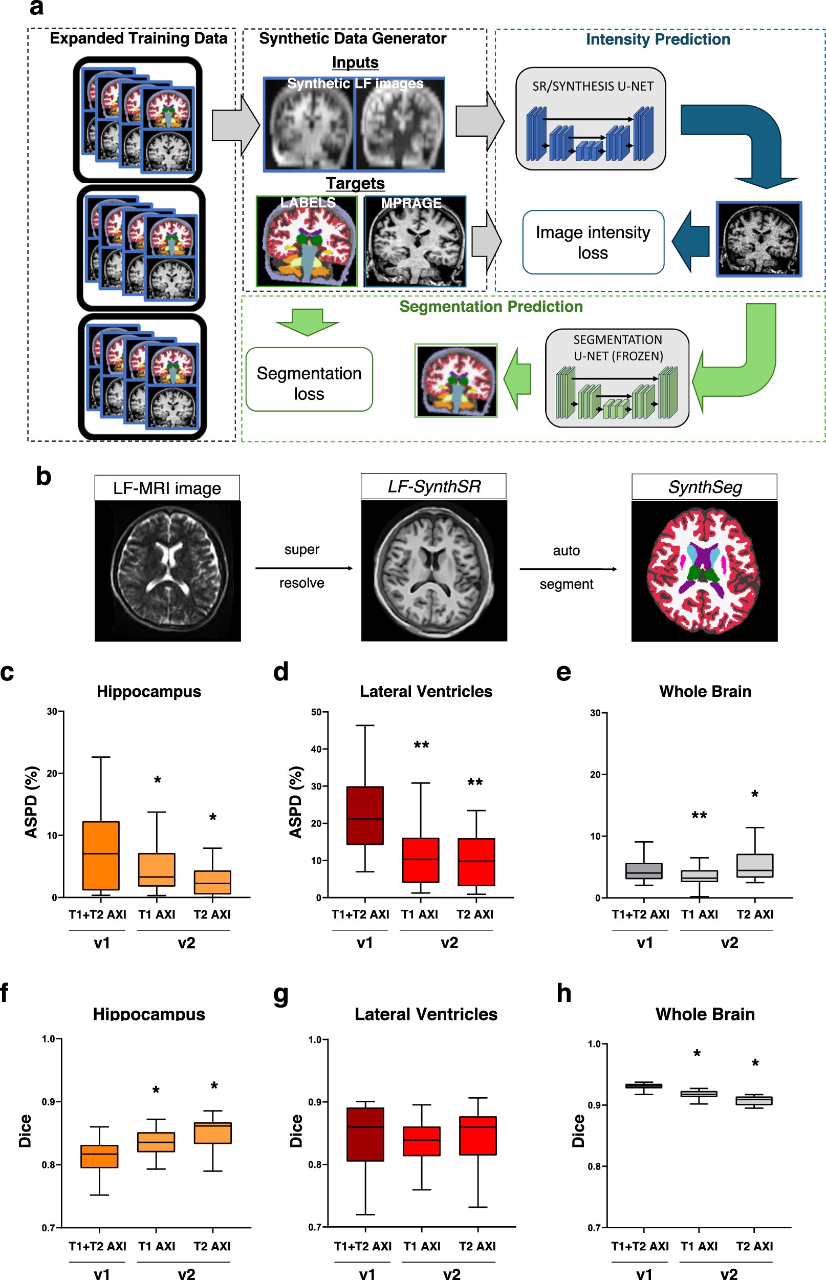 wtkimberly's tweet card. Nature Communications - Portable, low-field MRI of the brain may facilitate assessment of patients with Alzheimer’s disease. Here, the authors present and validate an end-to-end pipeline to...