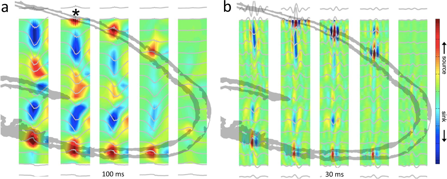 LMPrida's tweet card. Nature Communications - While the contribution of sharp wave ripples in memory consolidation and decision-making is established in rodent models, our understanding of their role in human memory is...