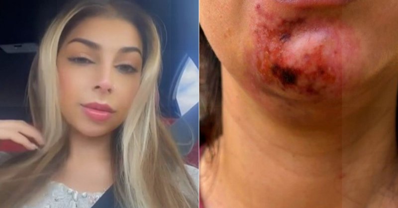 Tweet card summary image