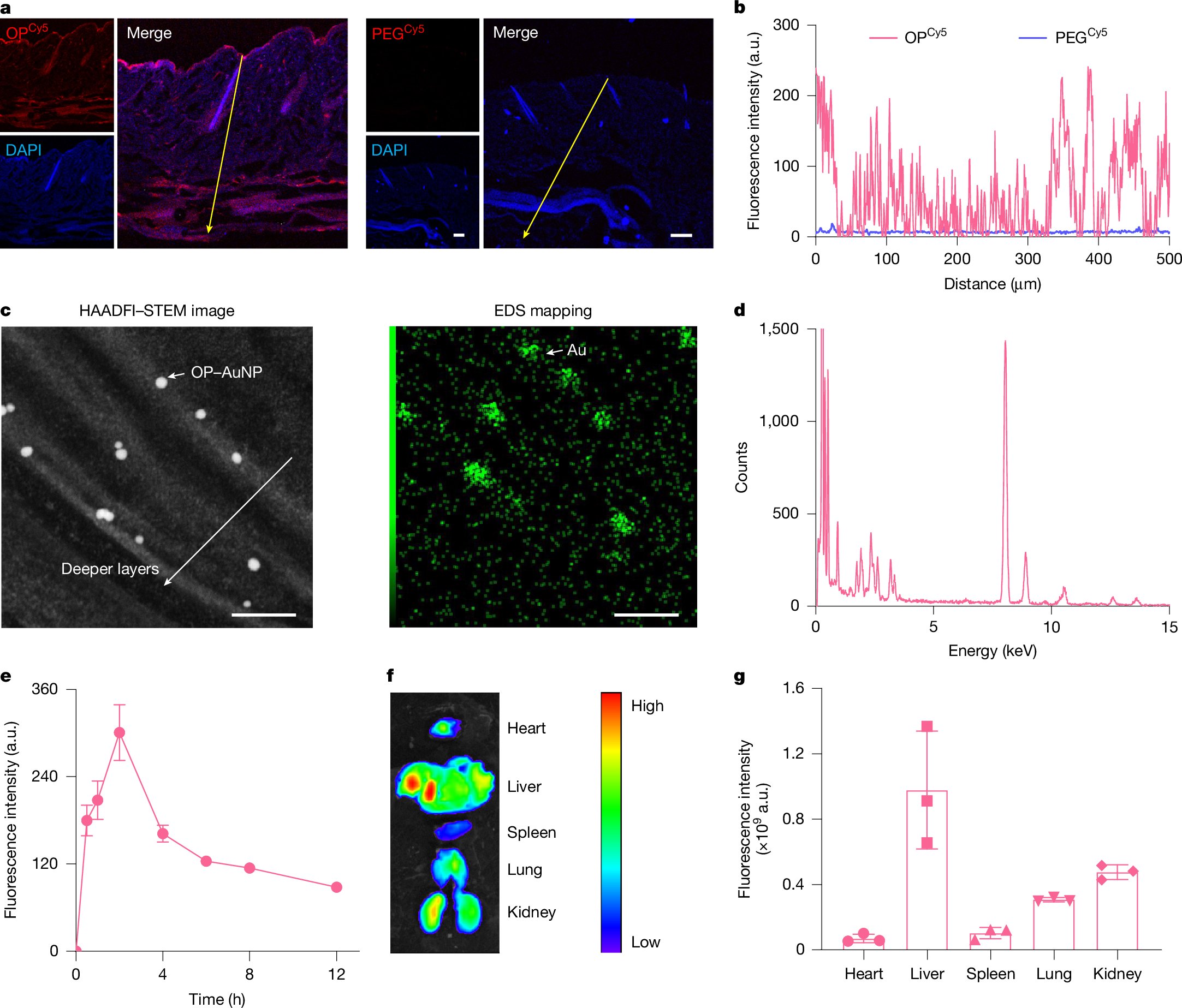 Nopanaden's tweet card. Nature - The fast skin-permeable polyzwitterion poly[2-(N-oxide-N,N-dimethylamino)ethyl methacrylate] may enable non-invasive transdermal delivery of insulin, and potentially facilitate the use of...