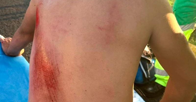 Tweet card summary image