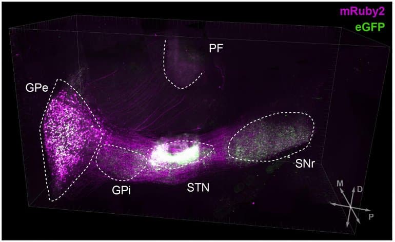 jazzmanahn's tweet card. Specific and identifiable neural pathways are altered with particular functions during the different progressive stages of Parkinson's disease.
