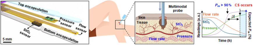 NU_QSIB's tweet card. A soft, minimally invasive multimodal sensor probe integrates intracompartmental pressure, tissue oxygen saturation, and blood flow sensors into a single platform. By enabling precise measurements...