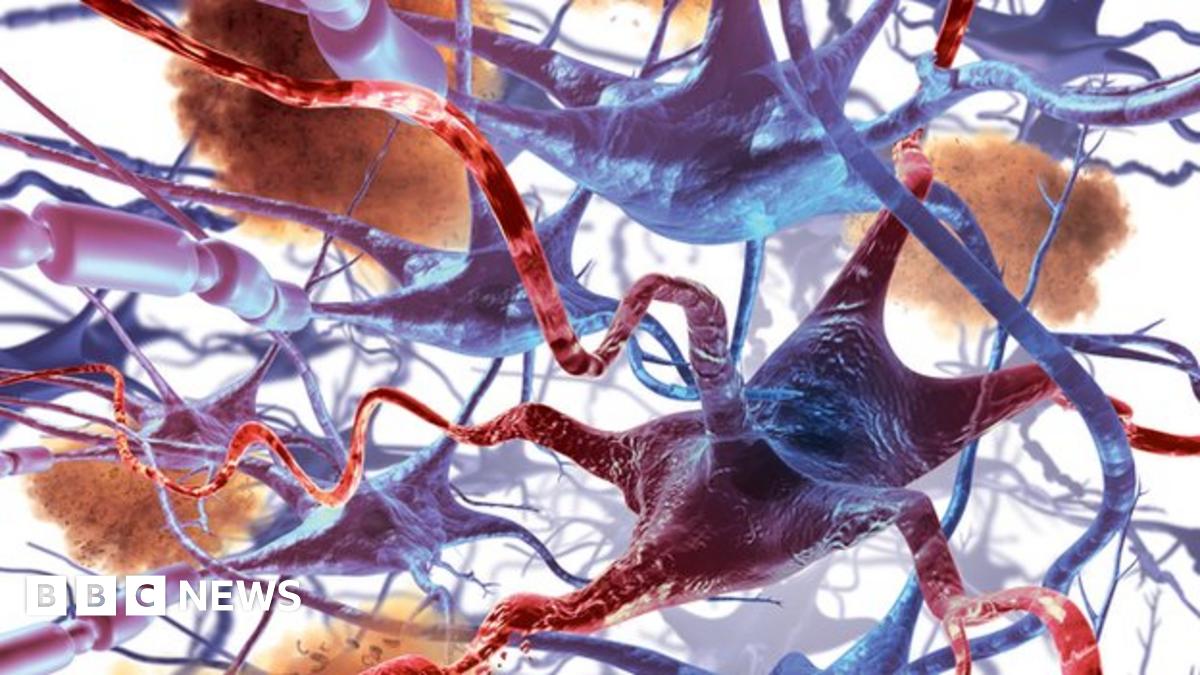 CSK_Psych's tweet card. Scientists have proposed a new idea for detecting brain conditions including Alzheimer's - a skin test.