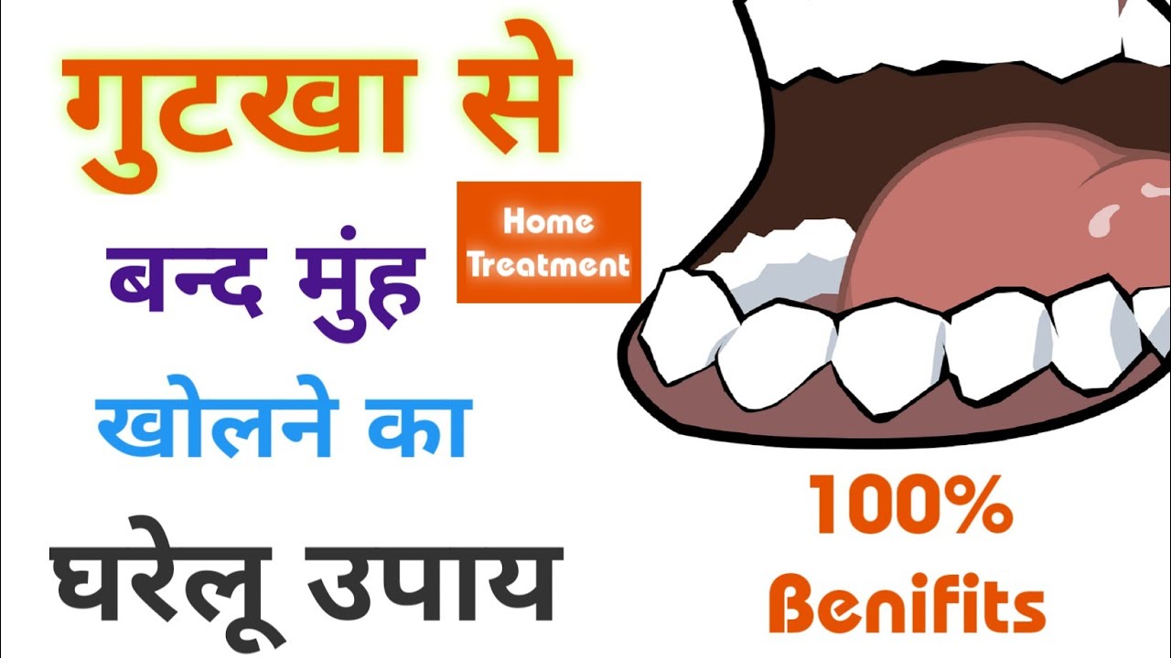 rajeshspnn's tweet card. Muh Khulne Ke Gharelu Upay: What is This Treatment?