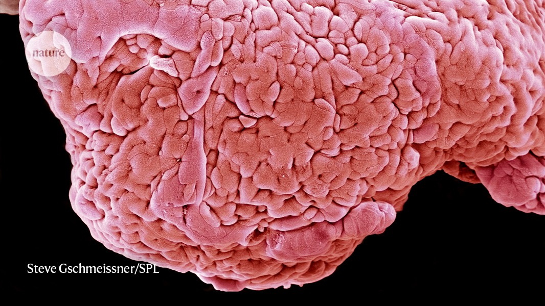 whatishealth21's tweet card. Nature - Signals originating in the brain make their way to gut nerve cells, leading to a release of inflammatory chemicals.