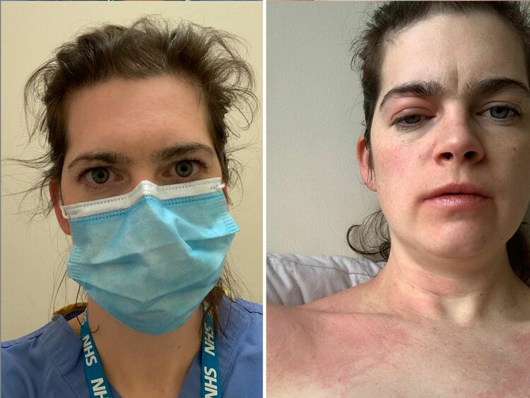 Sunny_Rae1's tweet card. Hundreds of doctors are planning to sue the NHS over claims inadequate PPE on the frontline has left them with long COVID, disabled, and in financial ruin.