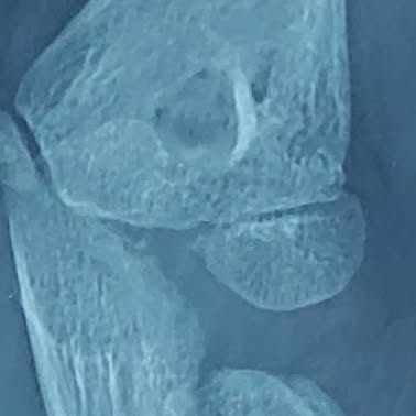 thatorthodoc's tweet card. Dr. Diksha | Dr. Pratik | The OrthoDerma Clinic | Gorakhpur (@orthoderma.in) • Instagram photos and...