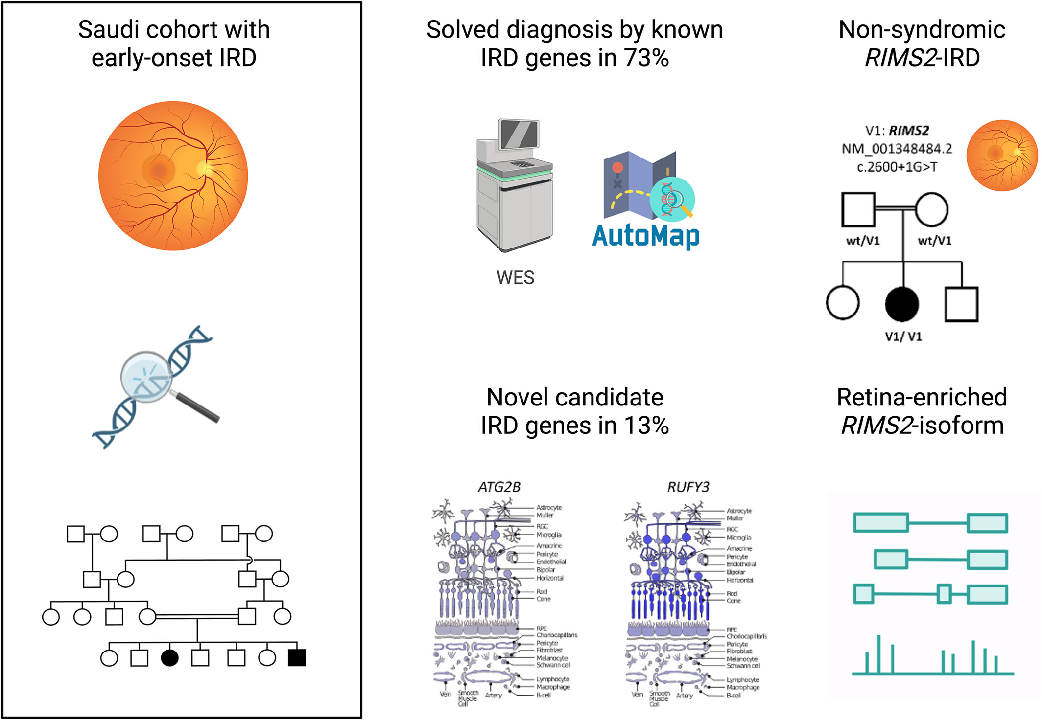DelpoMarta's tweet card. Autozygome-guided whole exome sequencing (WES) in Saudi families with early-onset inherited retinal disease revealed a diagnosis in 73%. Genotype-driven clinical reclassifications showed a novel...