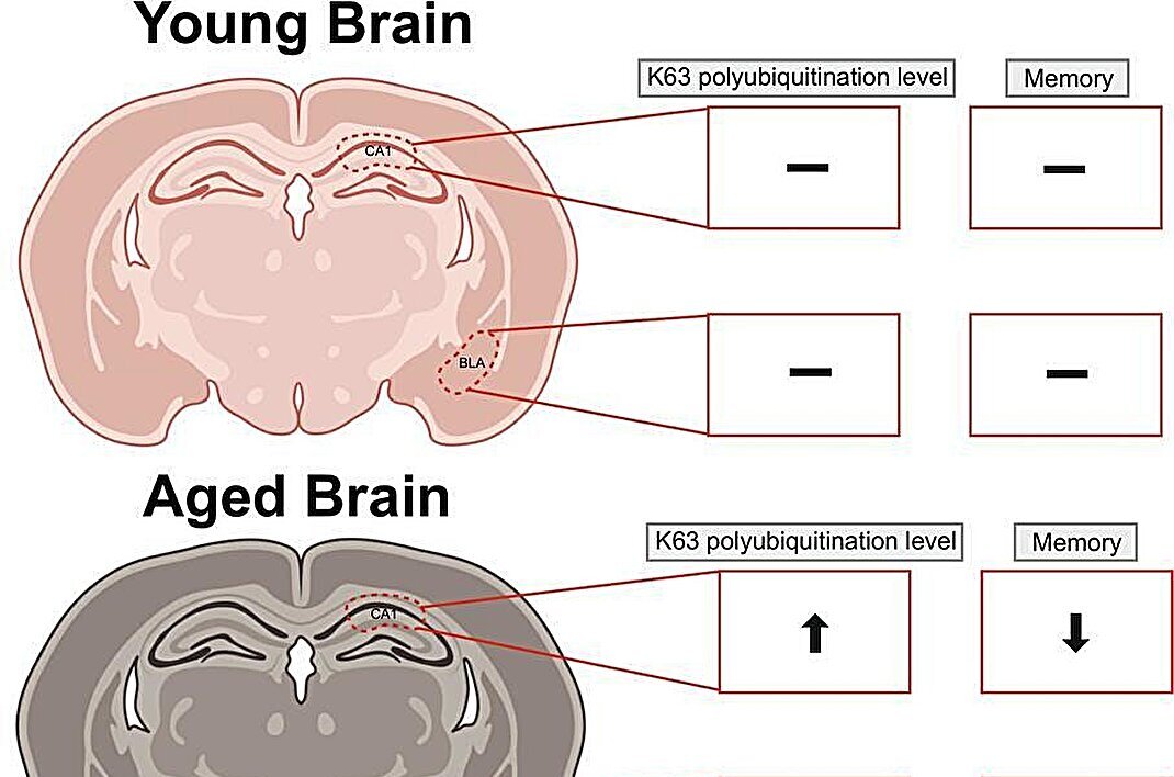 medical_xpress's tweet card. Memory loss may not simply be a symptom of getting older. New research from Virginia Tech shows that it's tied to specific molecular changes in the brain and that adjusting those processes can...