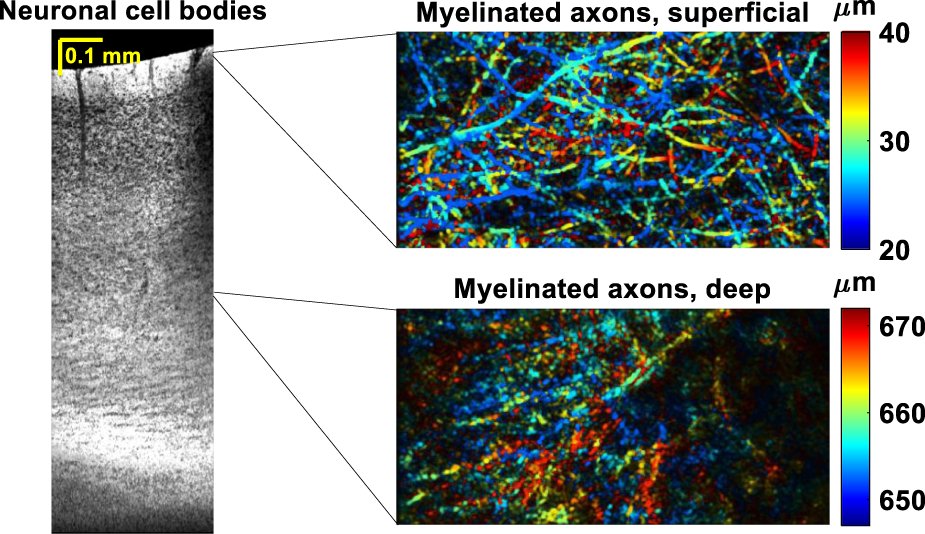 maiwending's tweet card. Light: Science & Applications - 1700 nm optical coherence microscopy images neurons and axonal myelination across the mouse neocortex and some sub-cortical regions, based on intrinsic...