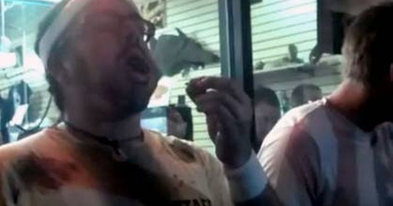 Tweet card summary image