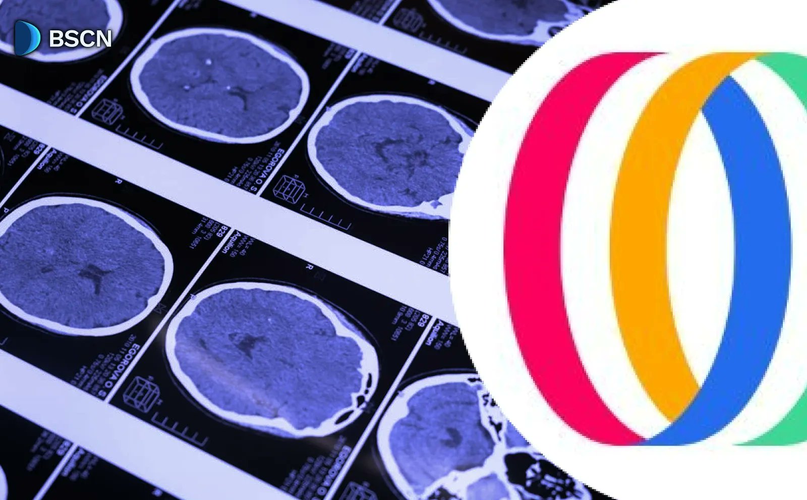 BSCNews's tweet card. Explore OpenMind's AI platform with OM1 OS, enhancing robot capabilities and Fabric network for secure machine interactions, backed by $20M funding and partnerships.