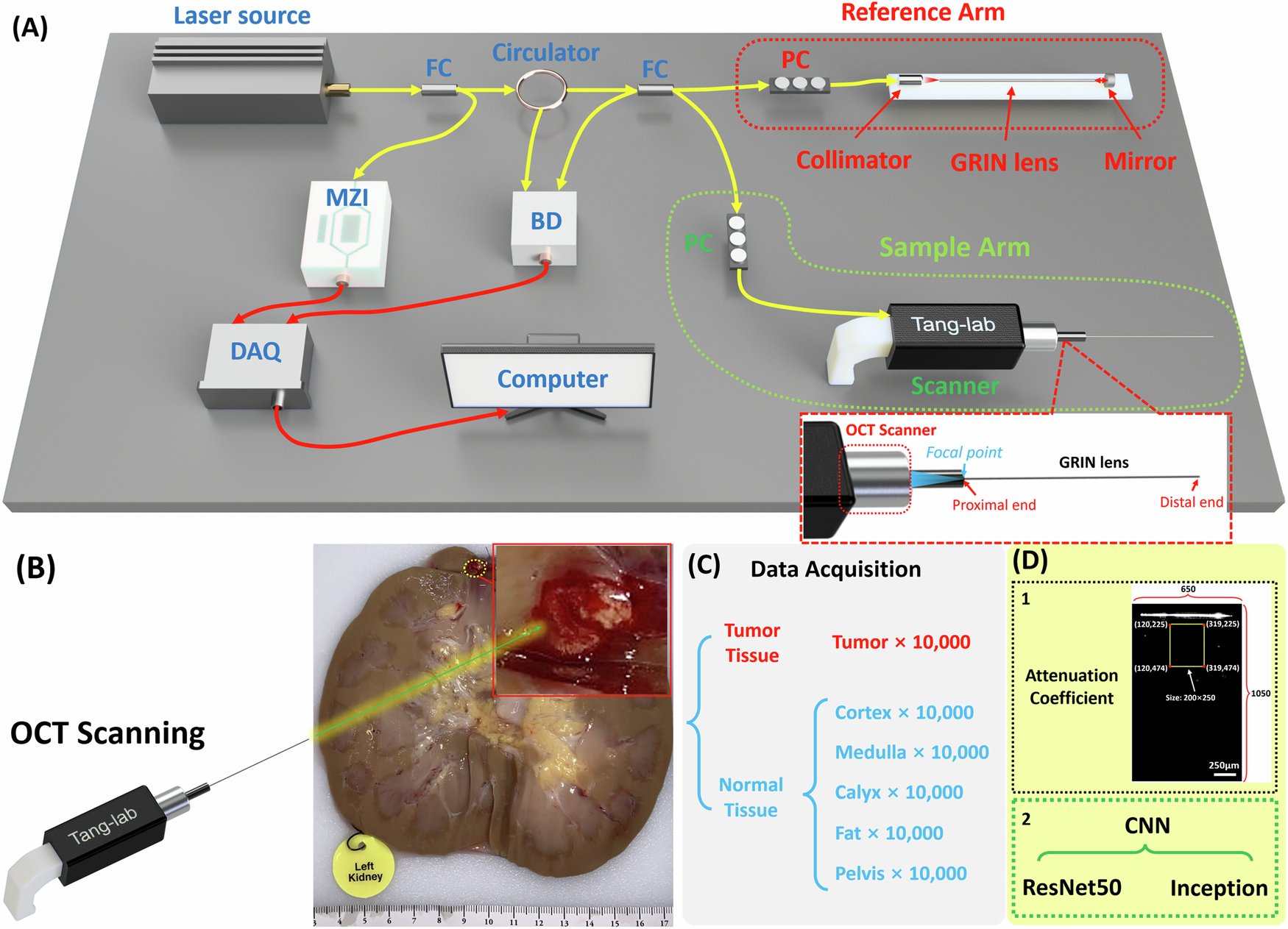 TangLab2's tweet card. Communications Engineering - Chen Wang and colleagues develop a forward-viewing optical coherence tomography endoscope for differentiating tumor tissues in renal biopsy. In conjunction with a...
