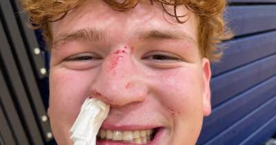 Tweet card summary image