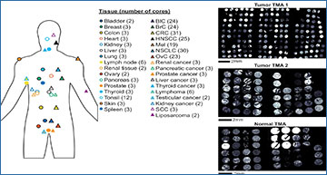 RNASeqBlog's tweet card. Systematic benchmarking of imaging spatial transcriptomics platforms in FFPE tissues
