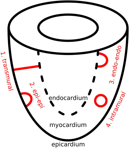 FrontNetPhysiol's tweet card. IntroductionIn previous research on reentrant atrial tachycardia (AT), the index theorem has proven instrumental in uncovering consistent paired counter-rota...