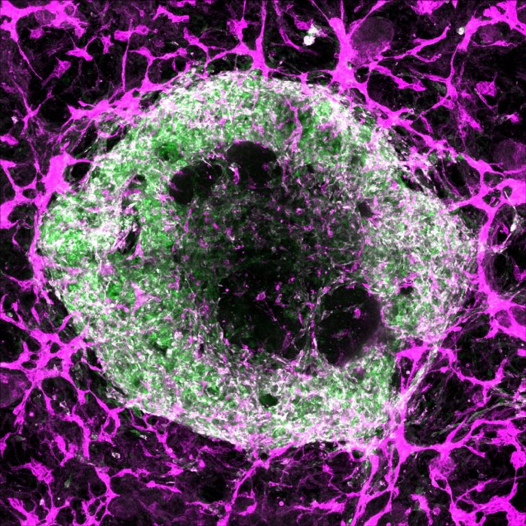 StanfordMed's tweet card. Stanford Medicine researchers developed a way to create the first heart and liver organoids that generate their own blood vessels, possibly paving the way for organoid-based regenerative therapies.