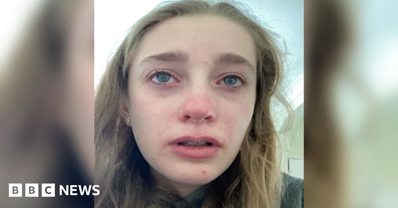 Tweet card summary image