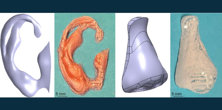 svk's tweet card. Researchers at Concordia University have devised a way to solidify liquid into plastic, creating a 3D-printing option that could be used to implement medical implants directly inside a patient's body