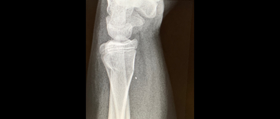 HelpMeViz's tweet card. Data visualizations are kind of like x-rays: sometimes we need to explain to people how to read them, not give up on making them altogether.