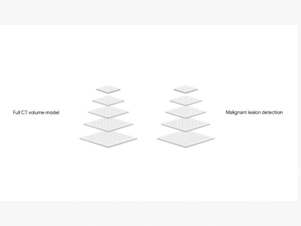 usemoslinux's tweet card. Los investigadores de IA de Google que trabajan con el Northwestern University Hospital han creado una IA que puede detectar el cáncer de pulmón.