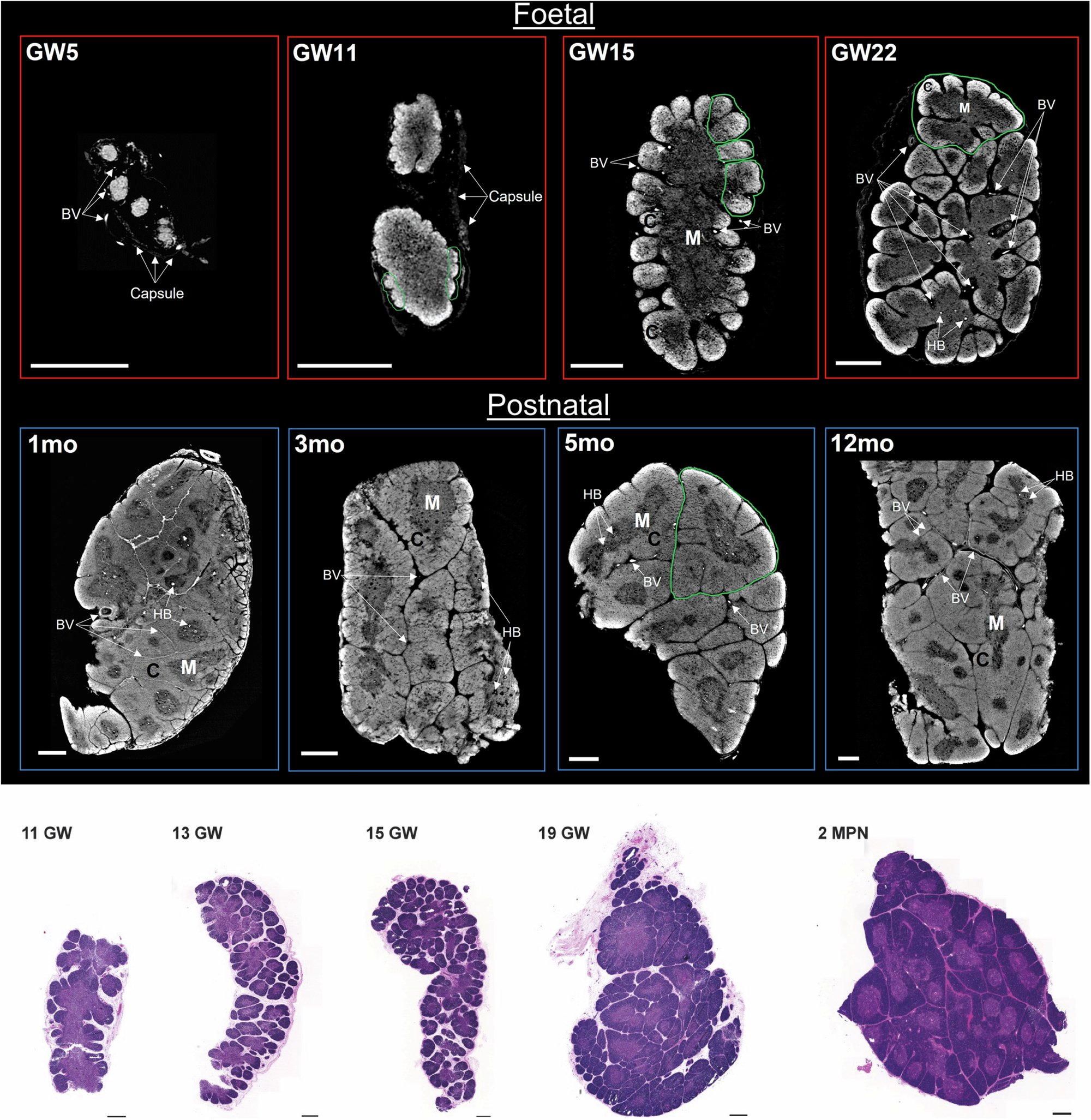 BonfantiLab's tweet card. Communications Medicine - Savvidis et al. present x-ray 3D imaging visualizing the internal anatomy of the human thymus across developmental stages. Quantification and evolution of Hassall’s...