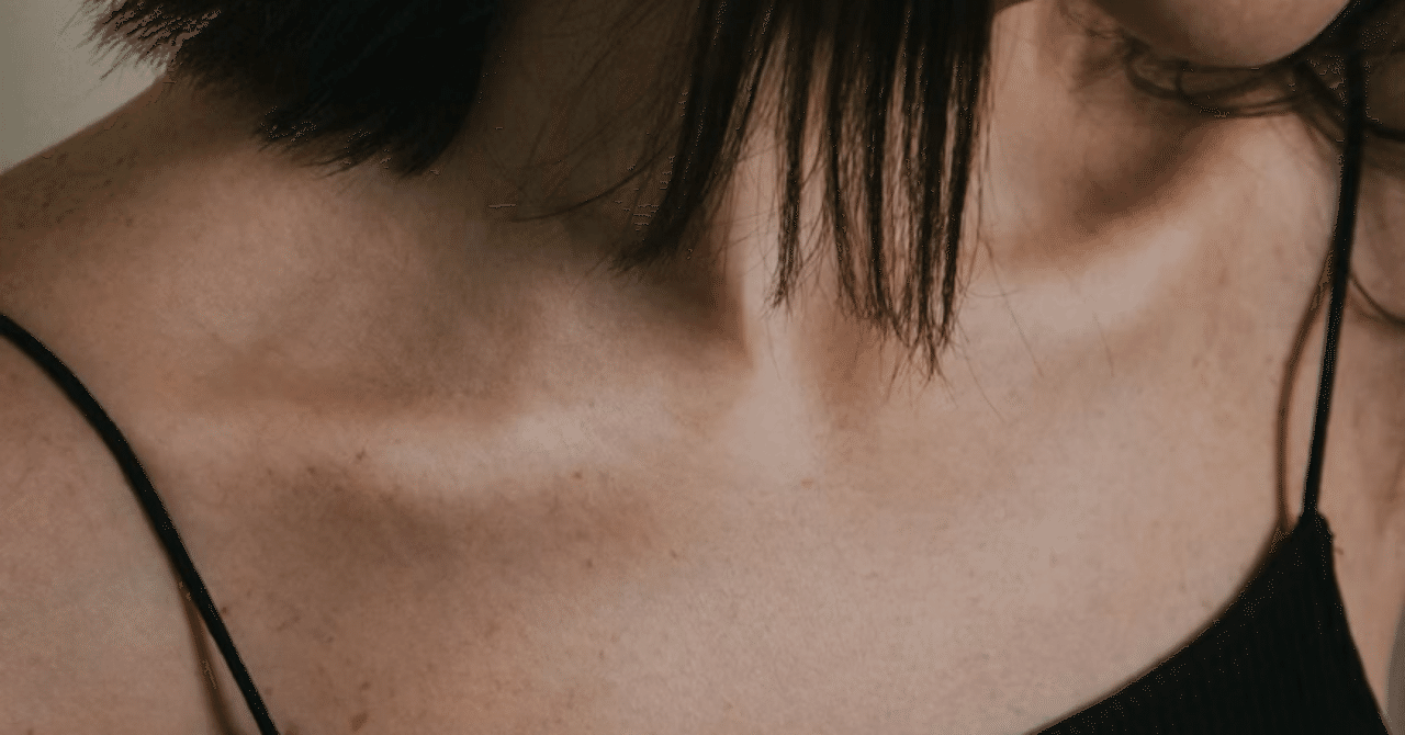 hikagenote's tweet card. 【臨床メモ】 痛みをとる系リハビリってほんと難しい！ 肩関節周囲炎とはまるで違います。 胸郭出口症候群（TOS：Thoracic Outlet Syndrome）のリハビリでは、原因筋や関節の理解と、それに応じたアプローチがポイントになります。 ✅胸郭出口症候群とは 腕神経叢・鎖骨下動静脈が 鎖骨と第1肋骨の間などで圧迫されて症状（しびれ・重だるさ・冷感など）がでる疾患 ✅TOSになりやす職業...