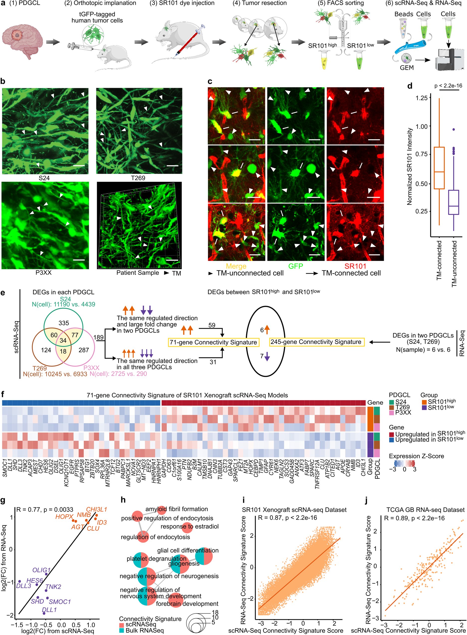 DirkCHoffmann's tweet card. Nature Communications - In glioblastoma (GBM), tumour microtubes (TM) connect tumour cells to a broader cellular network, with roles in tumour progression and therapy resistance. Here, the authors...