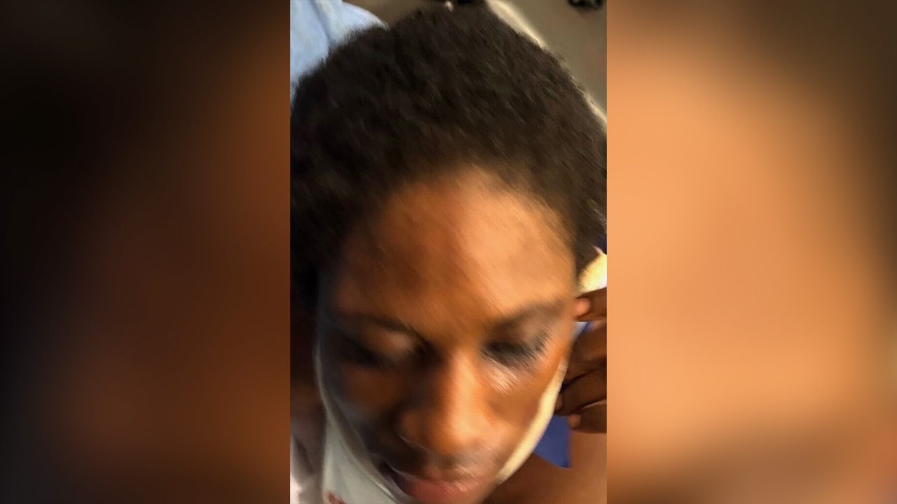 PositiveEnergyB's tweet card. According to state police, doctors who tended to her said she had an abrasion on her left hip and a road rash on her back.